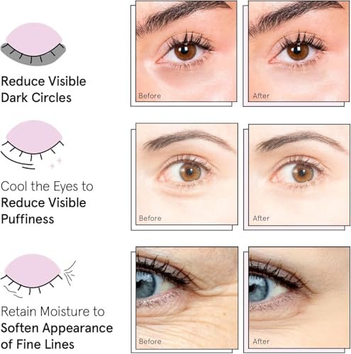 grace & stella Award Winning Under Eye Mask - Travel Essentials - Birthday Gifts for Women - Gel Eye Patches for Dark Circles, Puffy Eyes, Wrinkles, Undereye Bags - Vegan - Self Care (24 Pairs, Gold) - Image 8